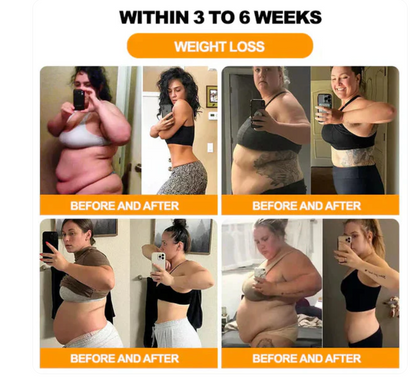 Vee Vesom Lymphatic Daiamage & Sliming Patches (10 Patches)